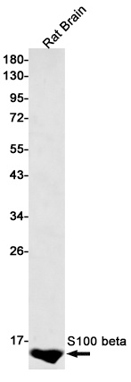 S100 beta Rabbit Monoclonal Antibody