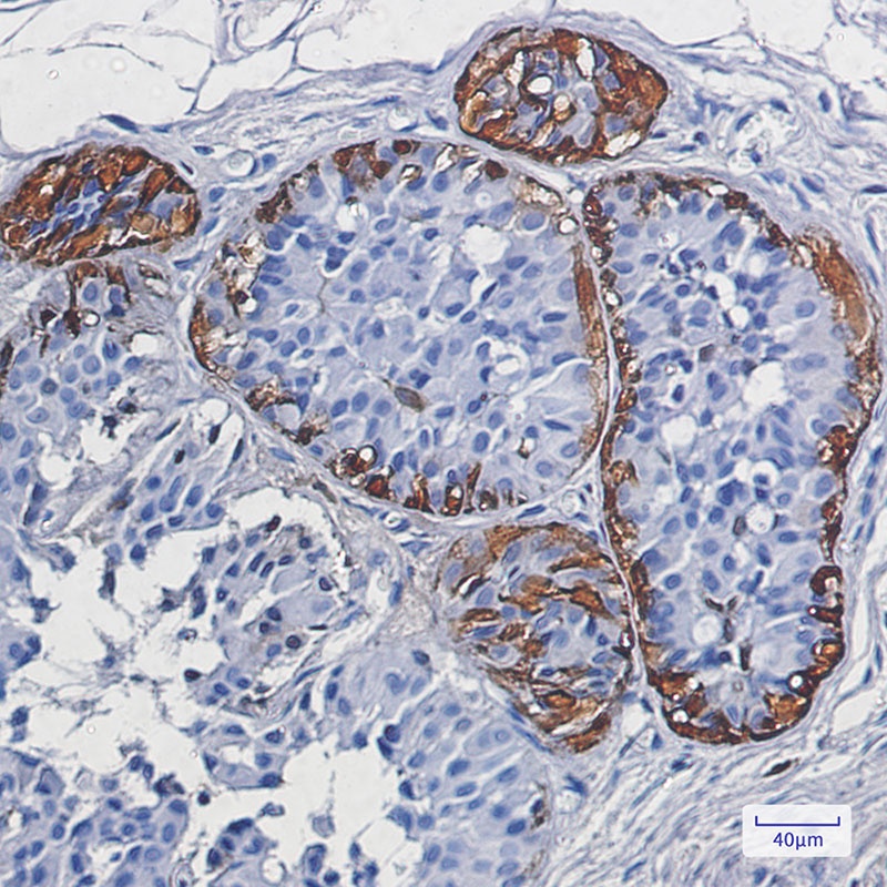 S100 beta Rabbit Monoclonal Antibody
