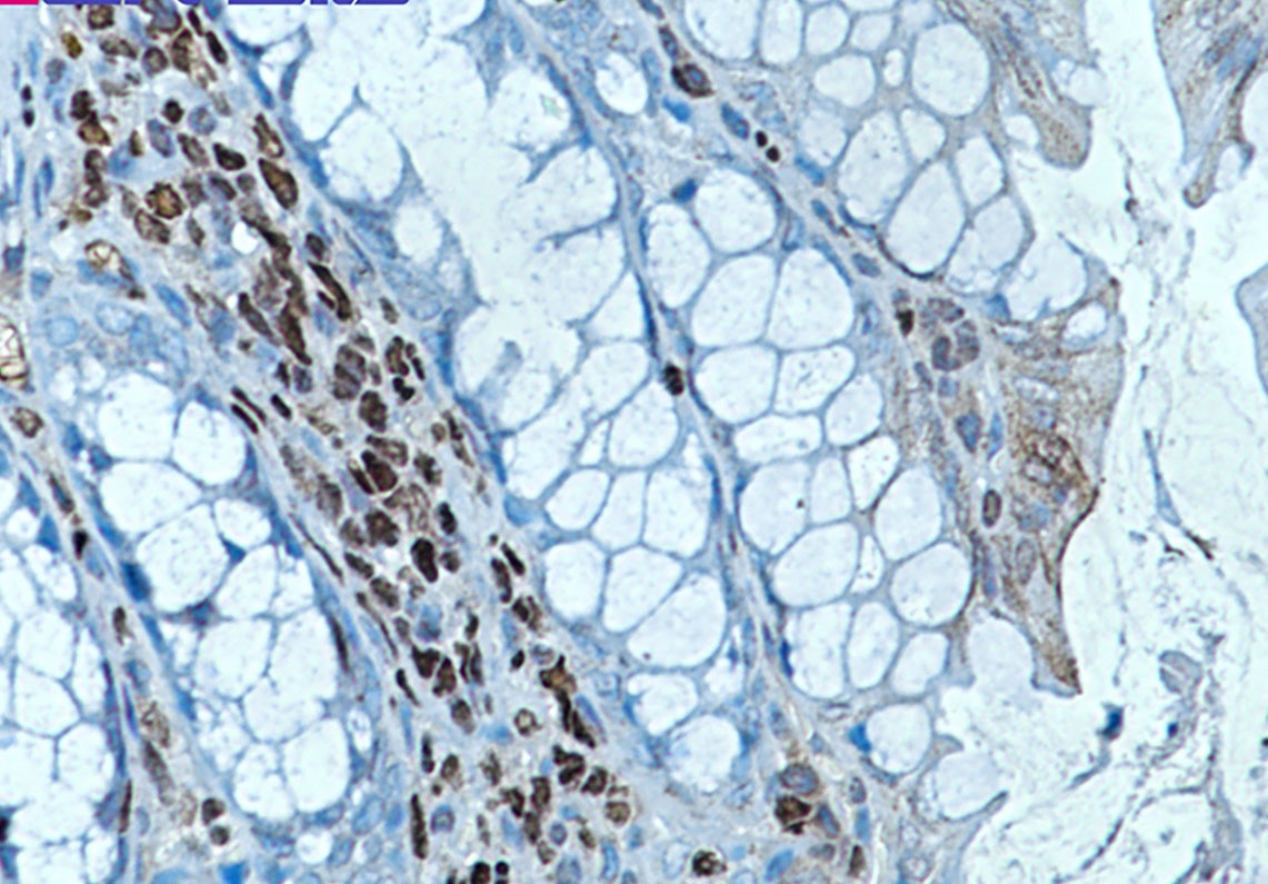 RUNX1/RUNX2/RUNX3 Antibody