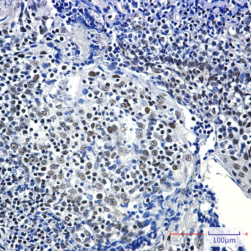 RPA2 Antibody
