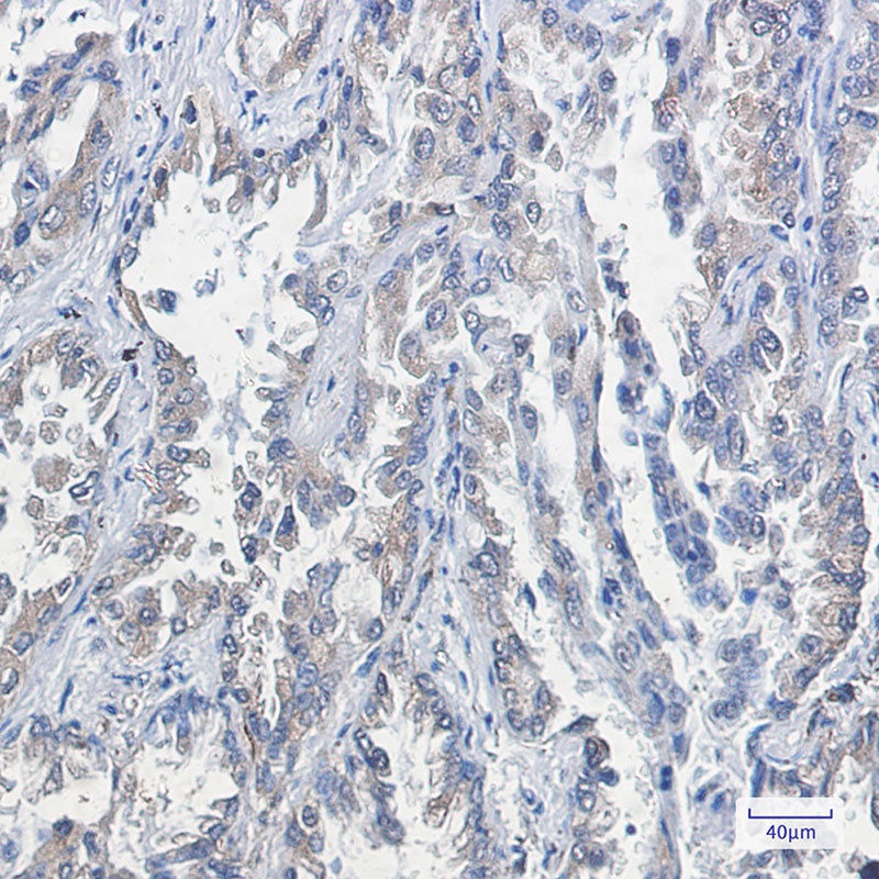 RAP1GAP Rabbit Monoclonal Antibody