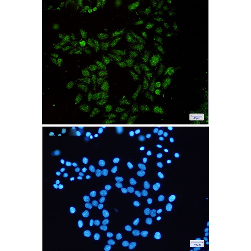RAP1GAP Rabbit Monoclonal Antibody