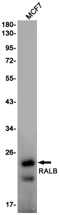 RALB Rabbit Monoclonal Antibody
