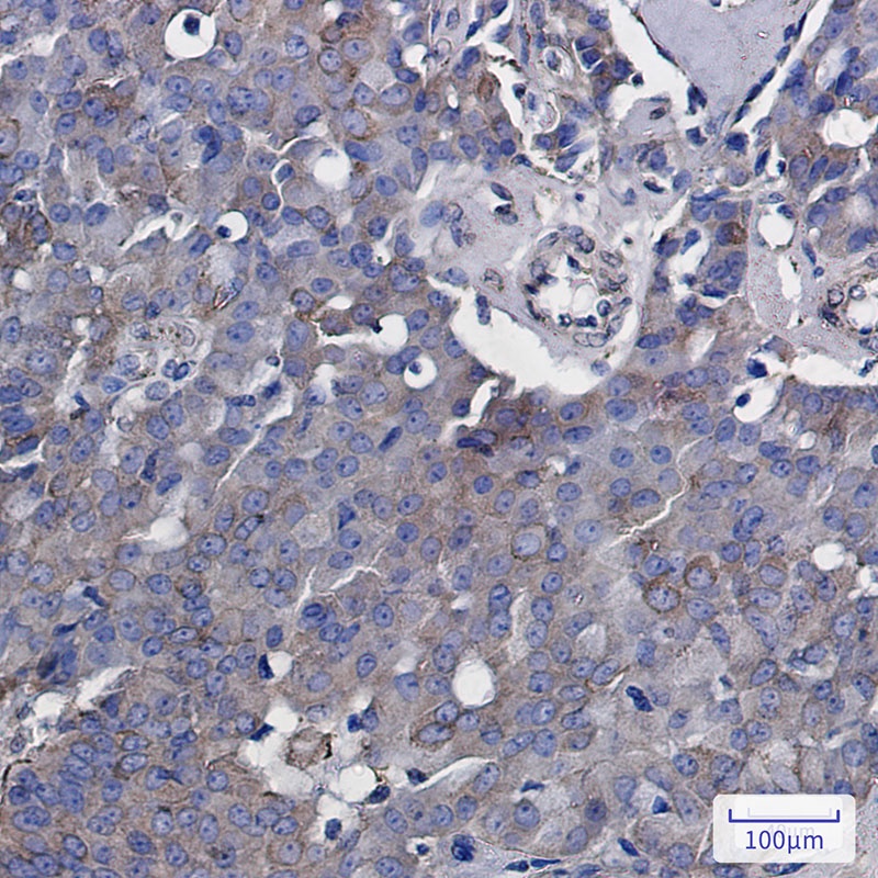 RAB5A Antibody