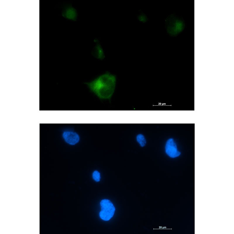 RAB5A Antibody