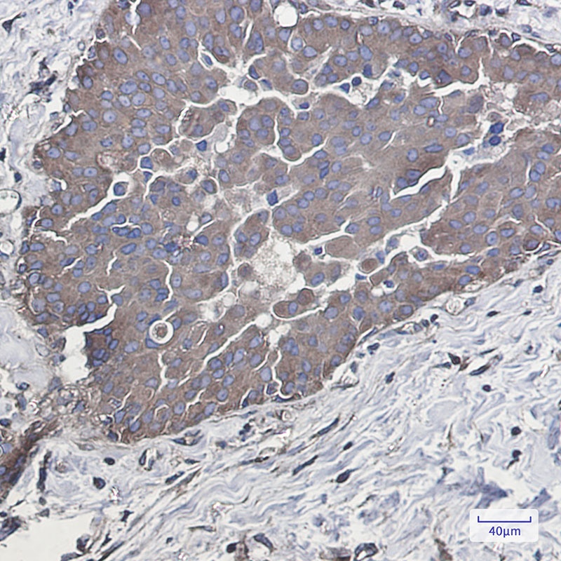 RAB5A Antibody