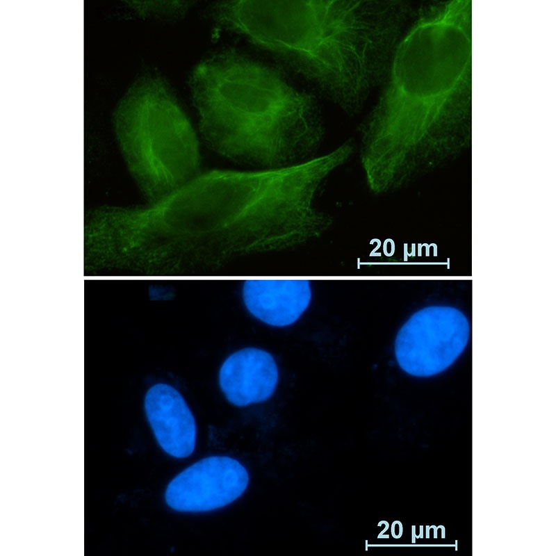 RAB10 Antibody