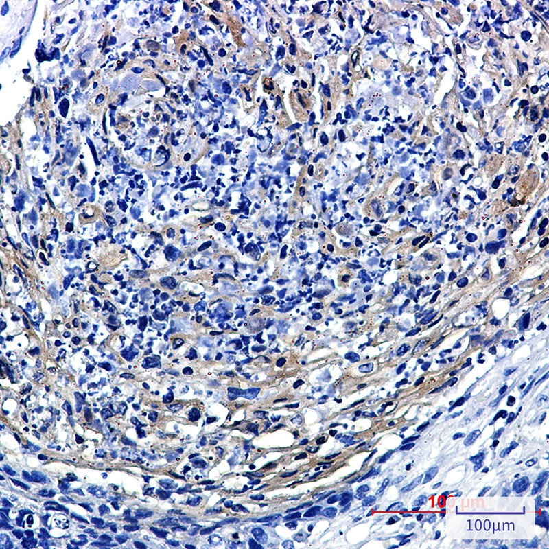 PRMT3 Antibody