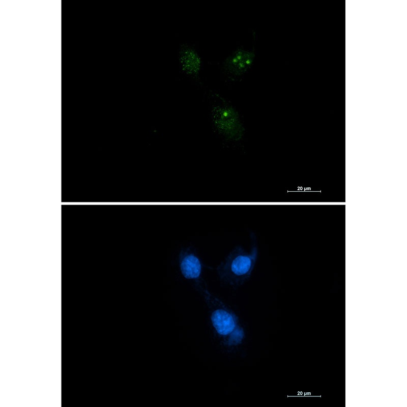 PSEN1 Antibody