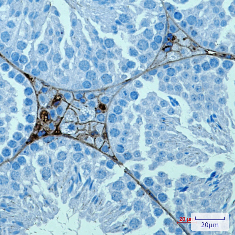 PRAME Antibody