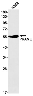 PRAME Antibody