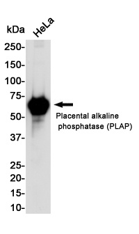 ALPP Antibody