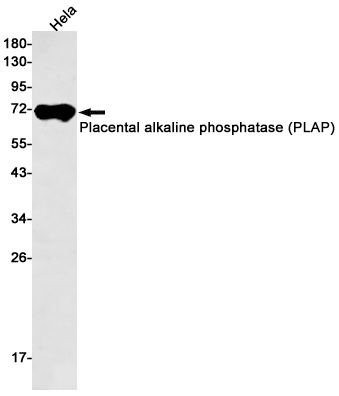 ALPP Antibody