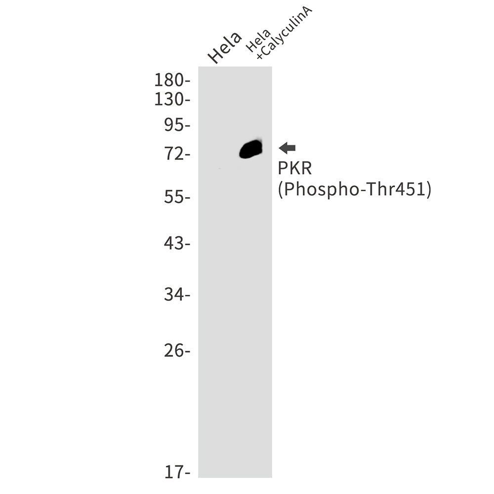 EIF2AK2 Antibody