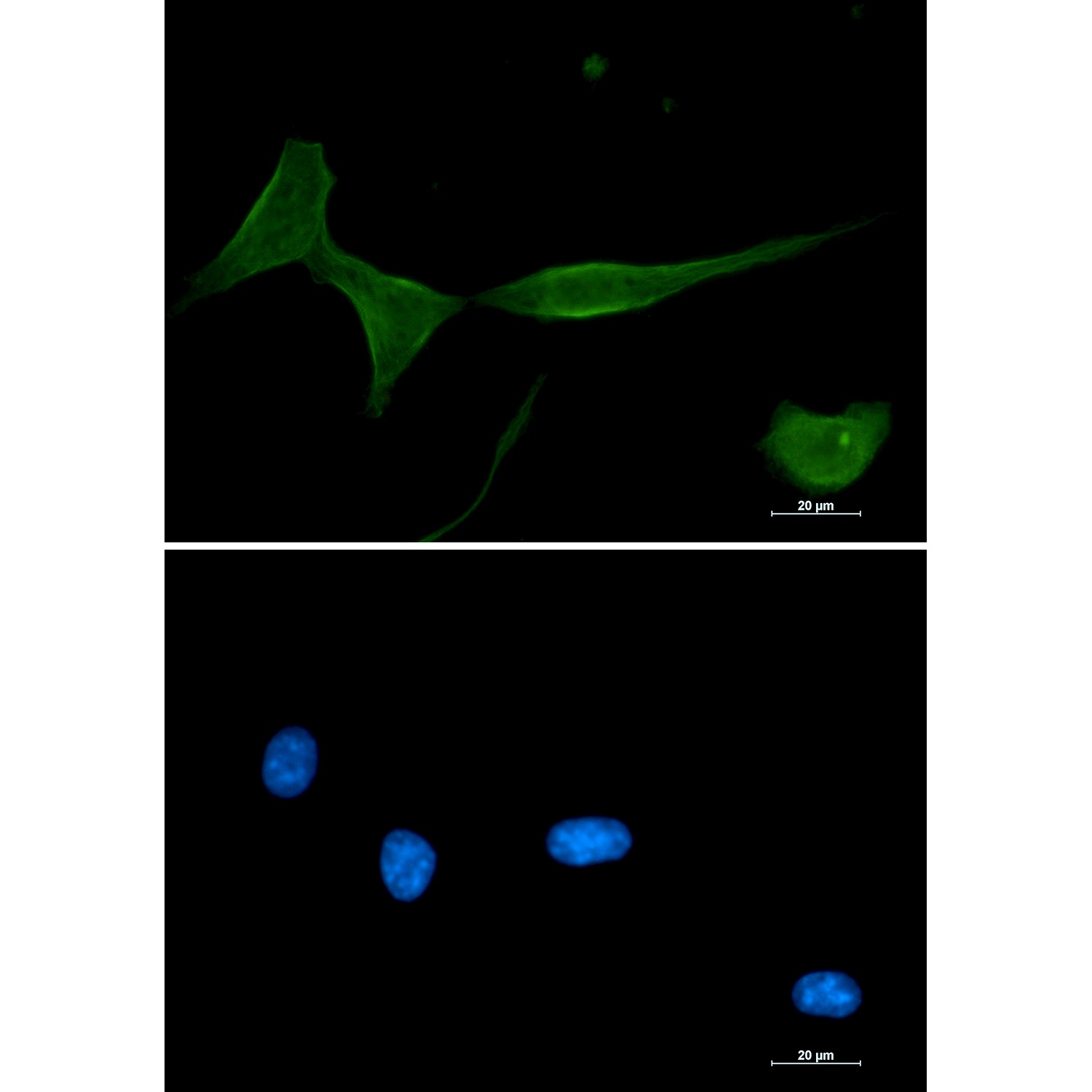 Prkcd Antibody