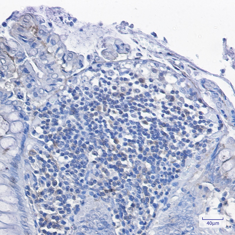 Prkcd Antibody