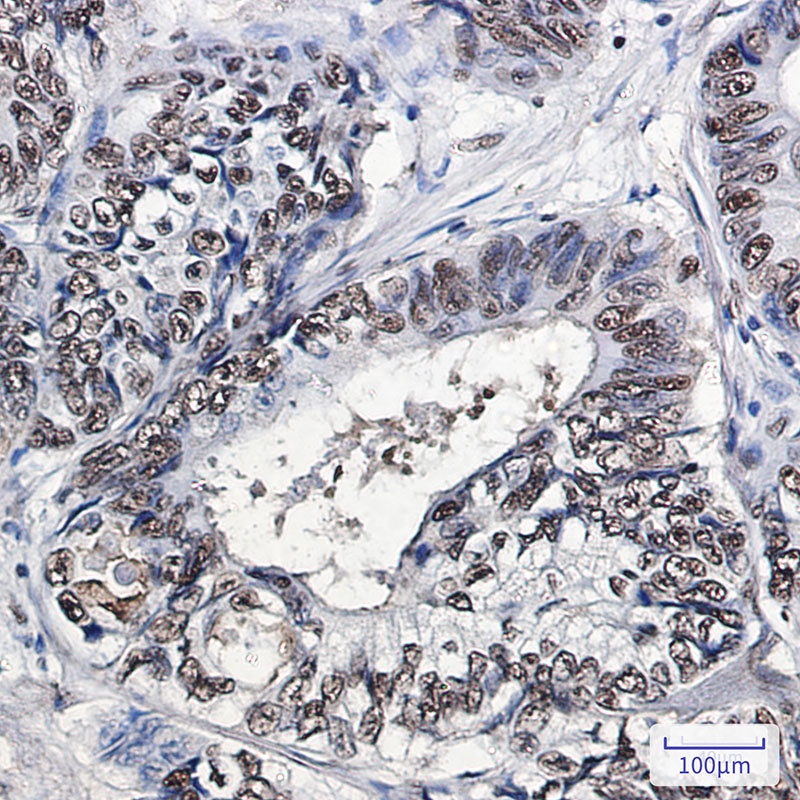 PHAPI2 Rabbit Monoclonal Antibody