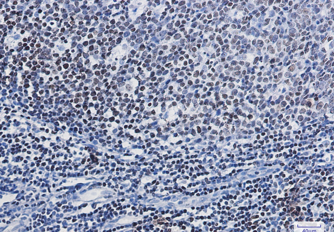 PARP1 Antibody