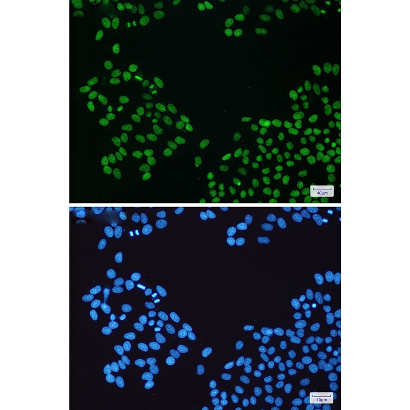 PARP1 Antibody