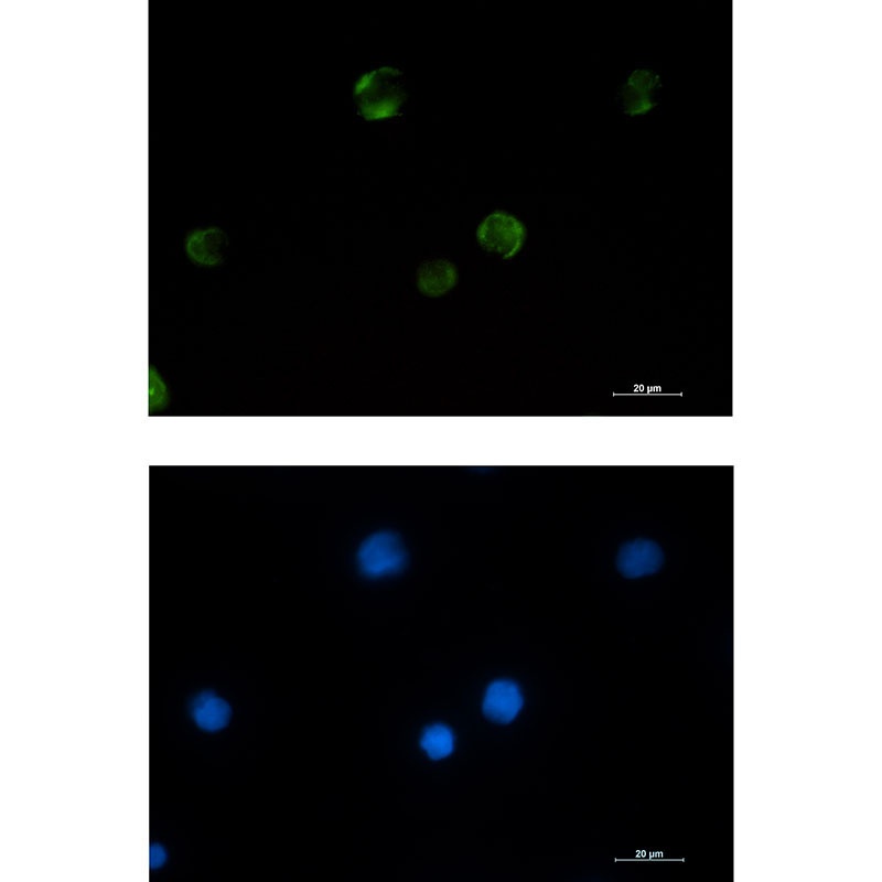PAK1 Antibody