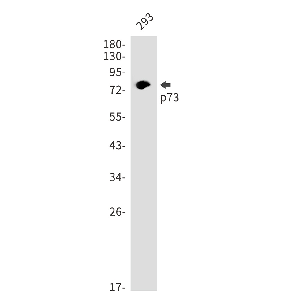 TP73 Antibody