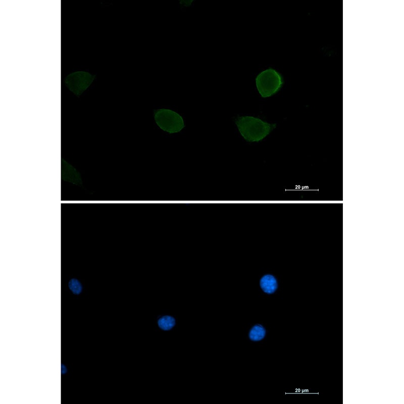 RPS6KB2 Antibody