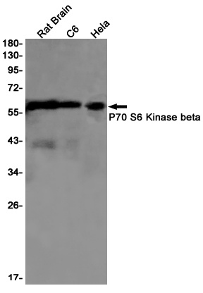 RPS6KB2 Antibody