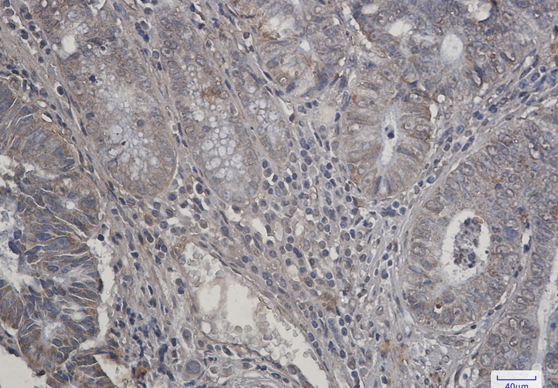 RPS6KB2 Antibody