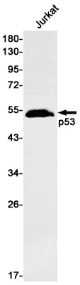 TP53 Antibody