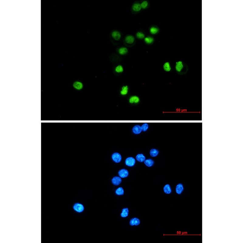 TP53 Antibody