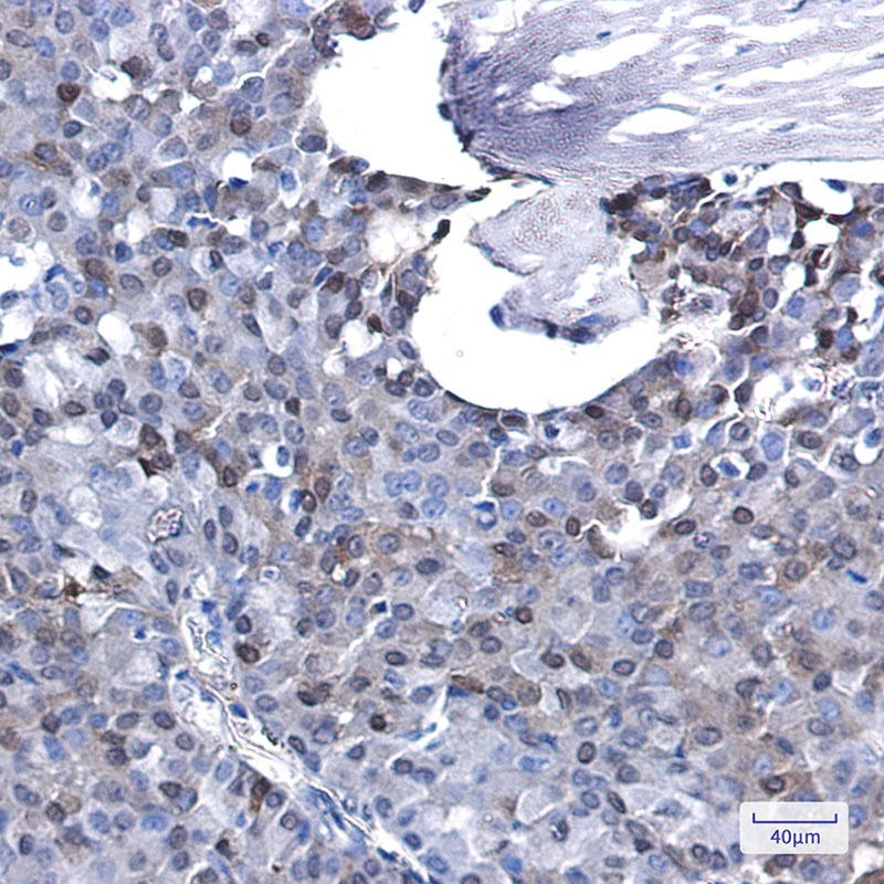 CDKN1B Antibody