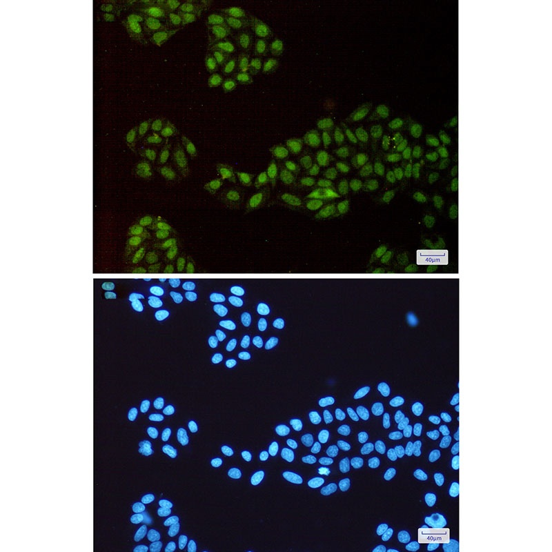 CHAF1A Antibody