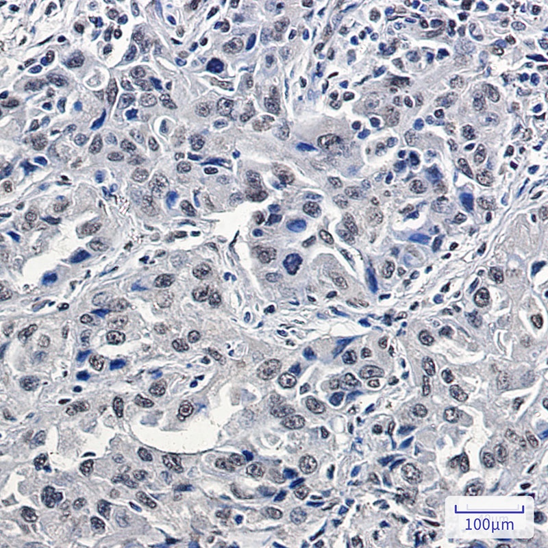 CHAF1A Antibody