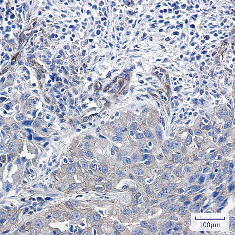 NUMB Antibody