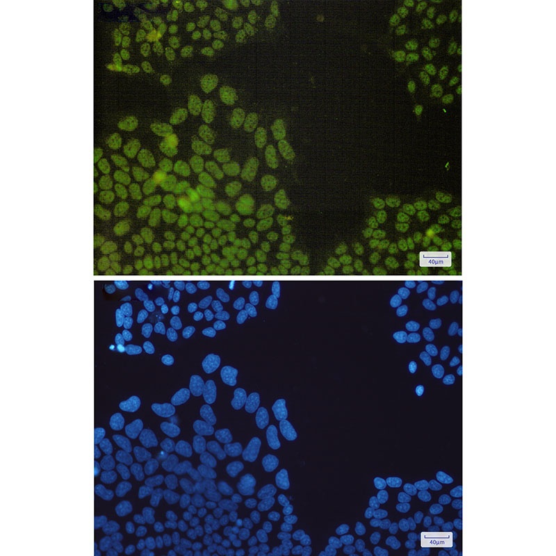 NRF1 Rabbit Monoclonal Antibody