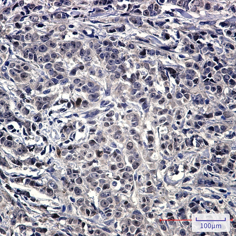 NOLC1 Rabbit Monoclonal Antibody