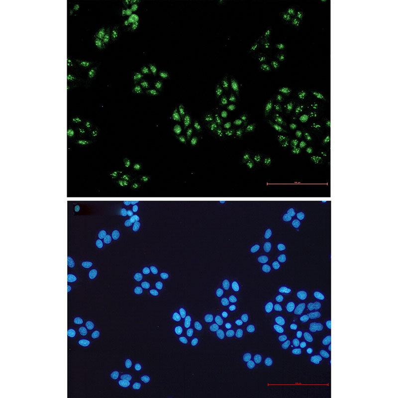 NOLC1 Rabbit Monoclonal Antibody