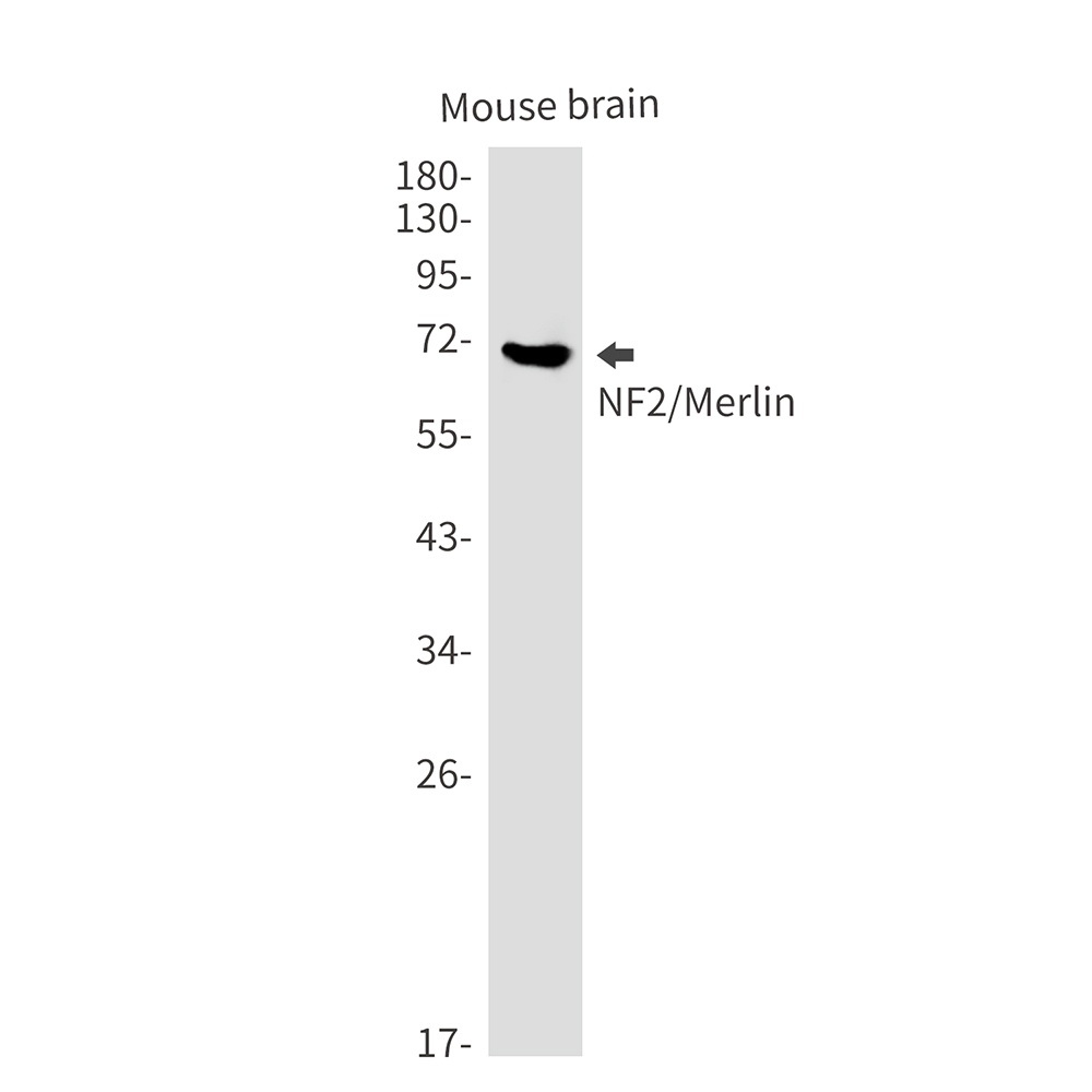 NF2 Antibody
