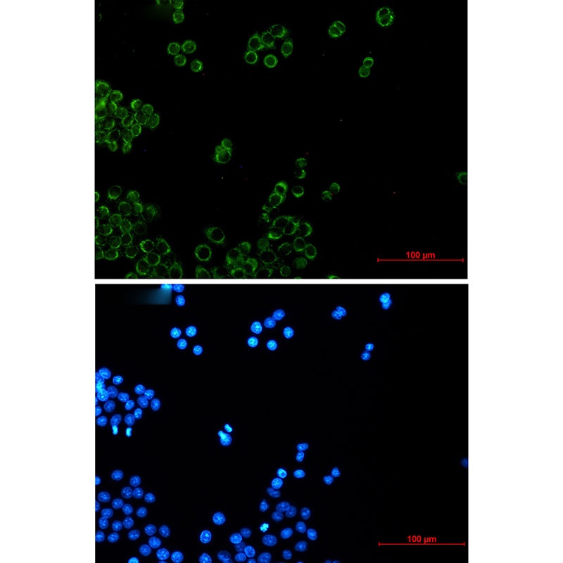 NDUFB4 Antibody