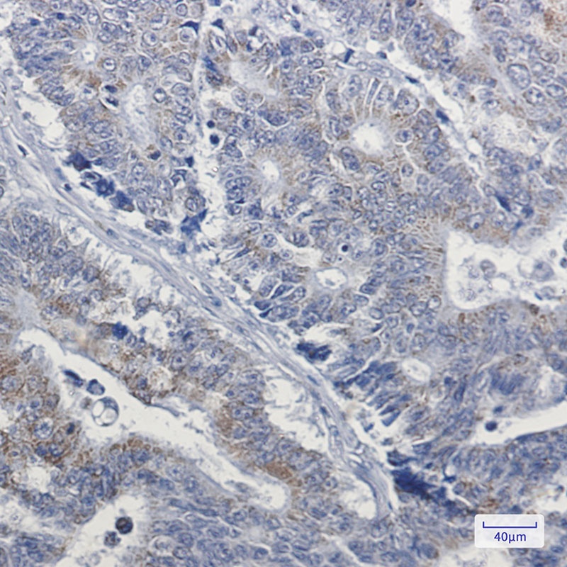 NDUFB4 Antibody