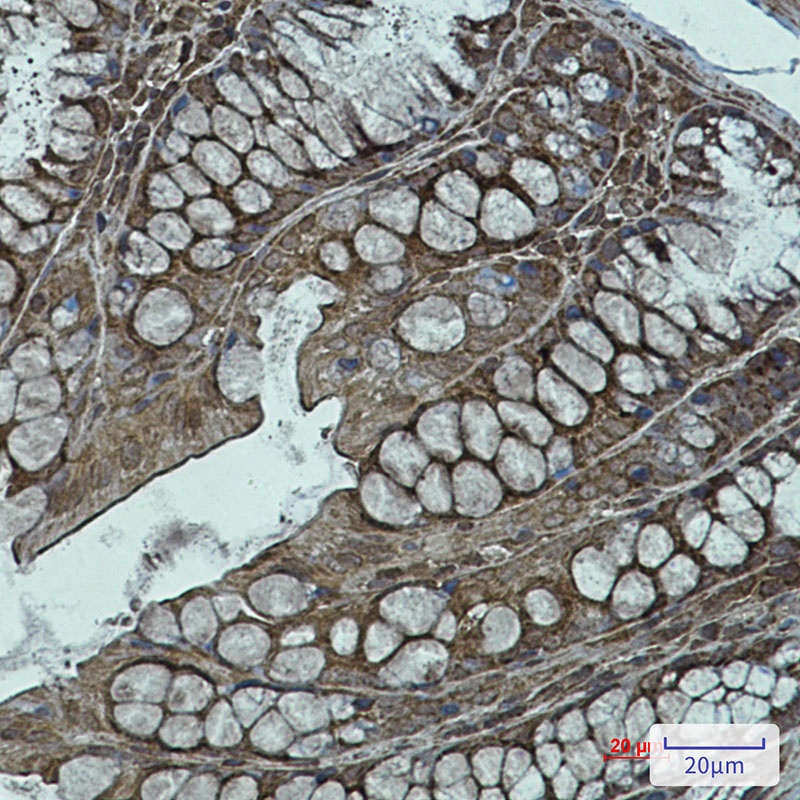 NDUFB11 Antibody