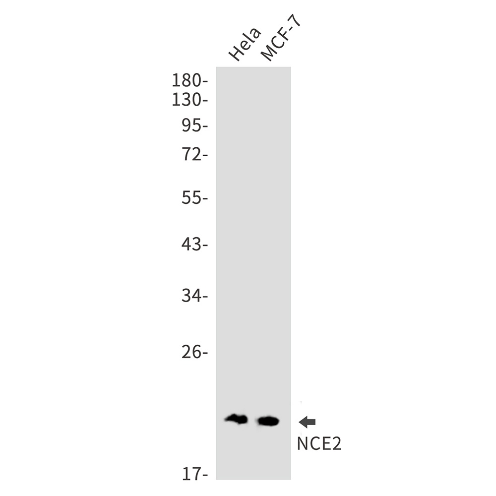 UBE2F Antibody