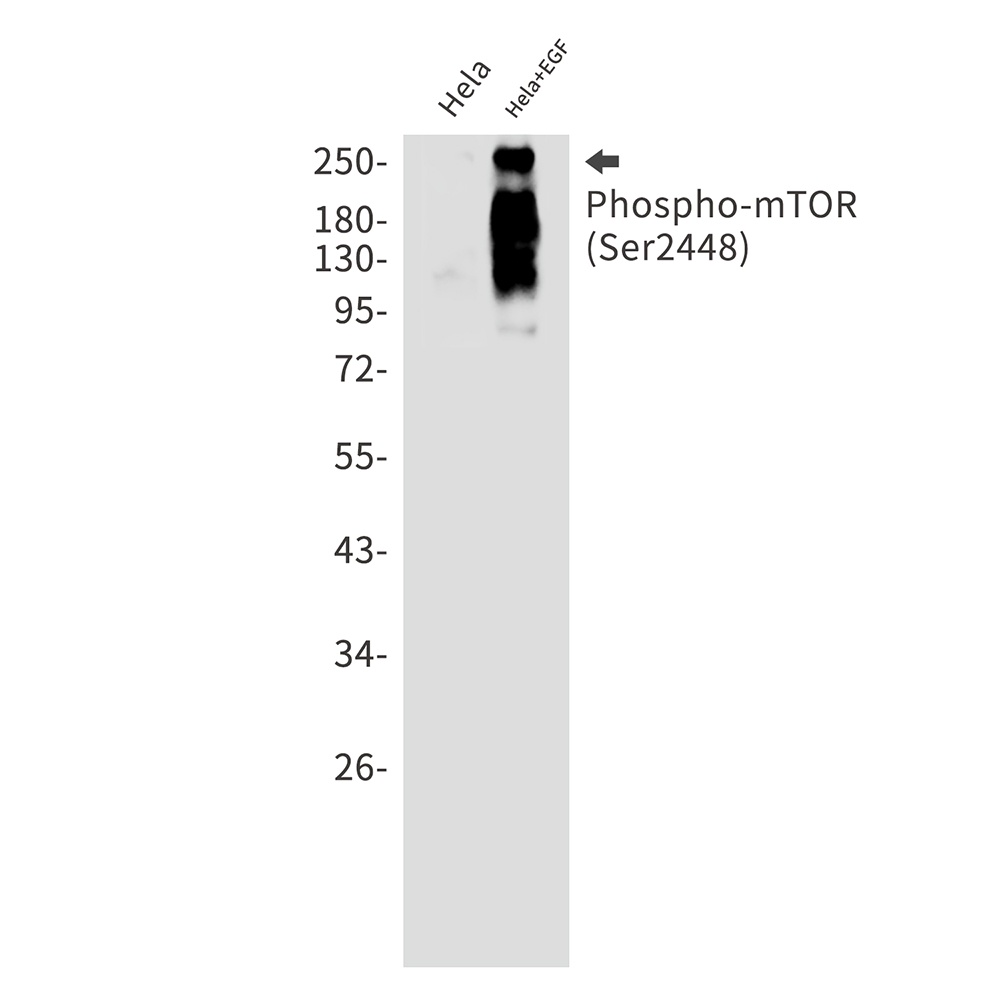 Phospho-mTOR (Ser2448) Rabbit Monoclonal Antibody