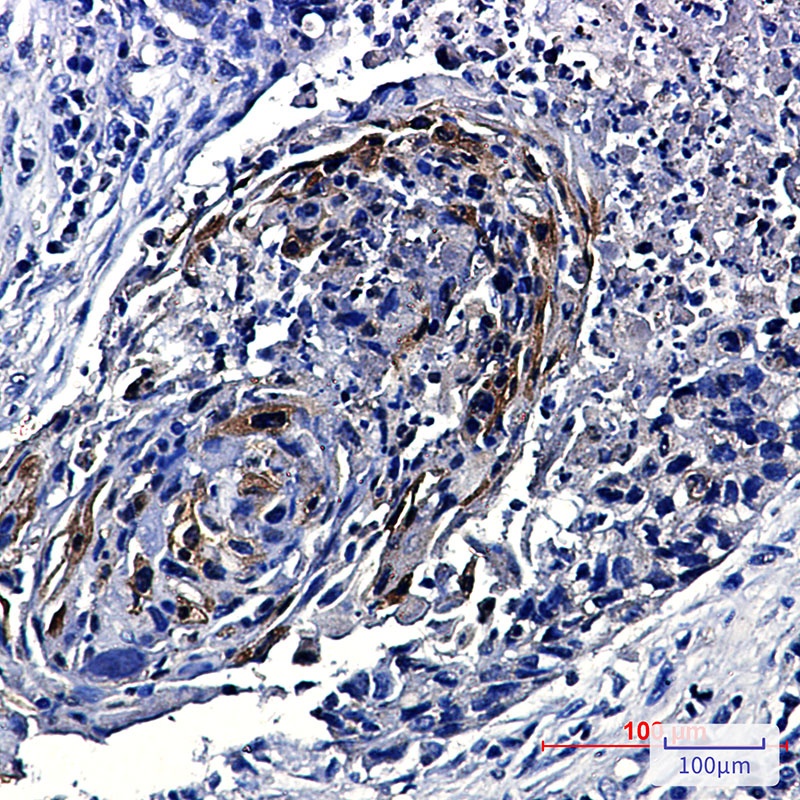 Phospho-mTOR (Ser2448) Rabbit Monoclonal Antibody