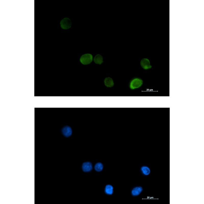 MTHFR Antibody
