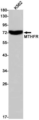 MTHFR Antibody