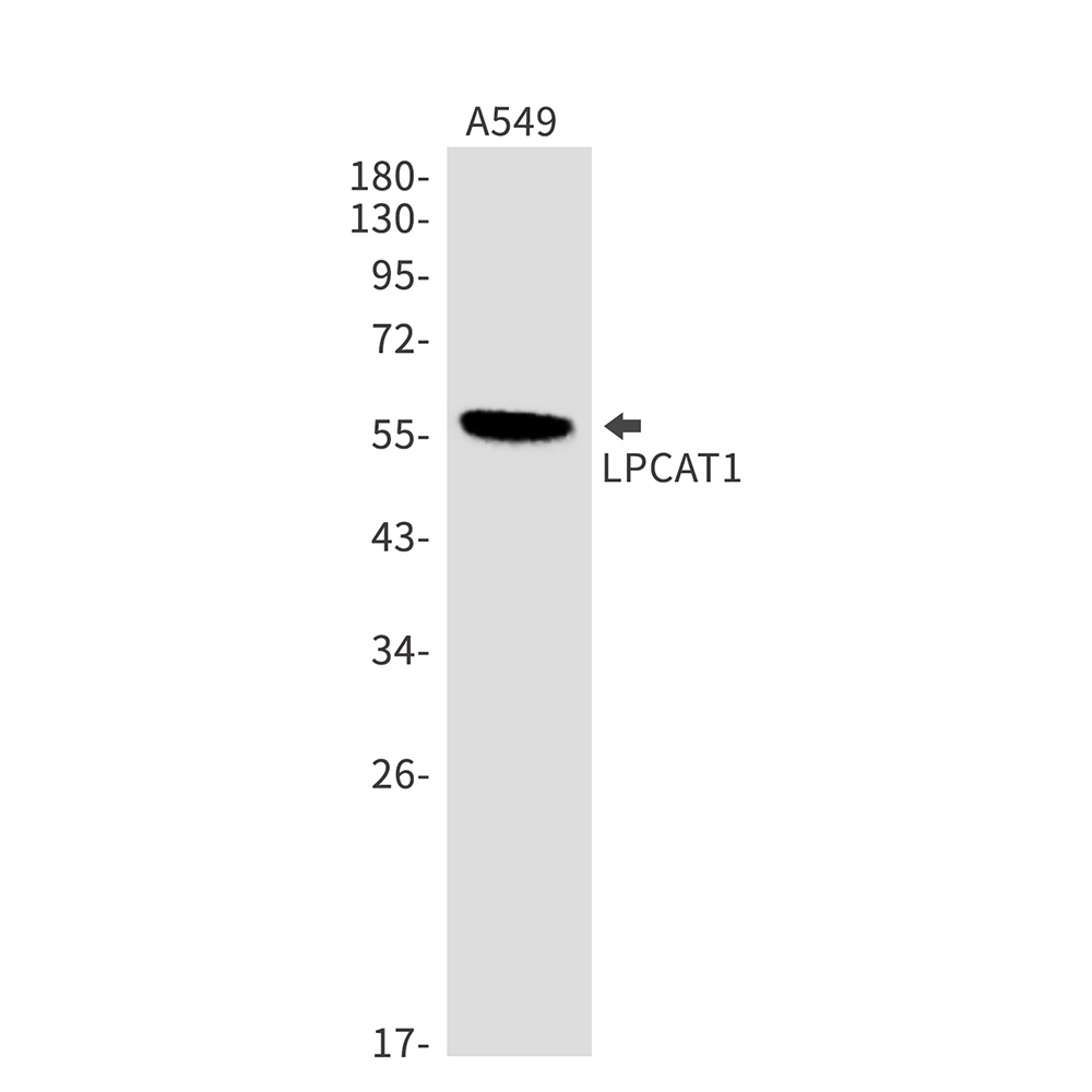 LPCAT1 Antibody