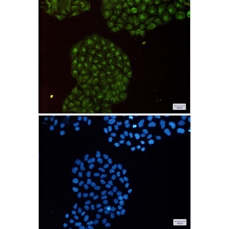 PSMB8 Rabbit Monoclonal Antibody