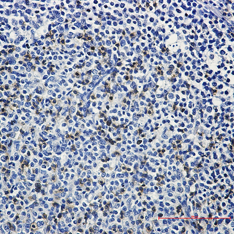 LAT Antibody