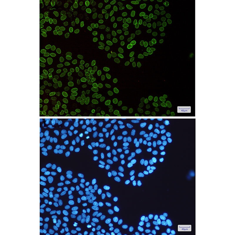 Lamin B2 Rabbit Monoclonal Antibody